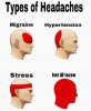 Types of Headaches 29122019195835.jpg